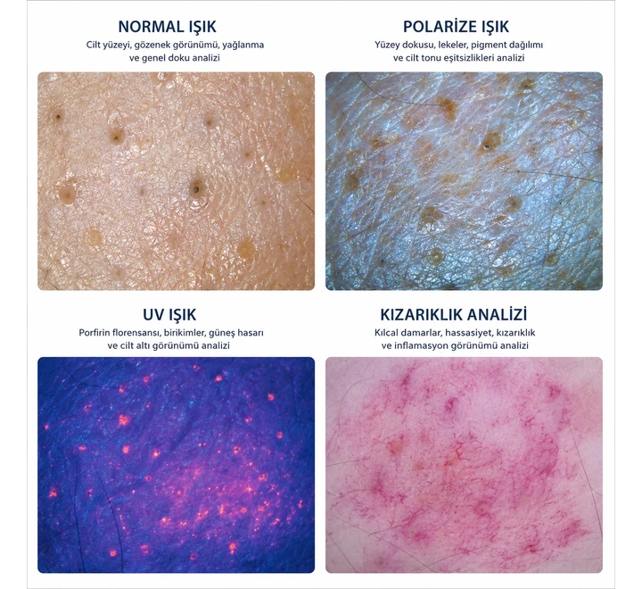 Cilt ve Saç Analiz Cihazı – Dijital Ekranlı UV ve Polarize Işıklı Analiz Sistemi - Görsel 5