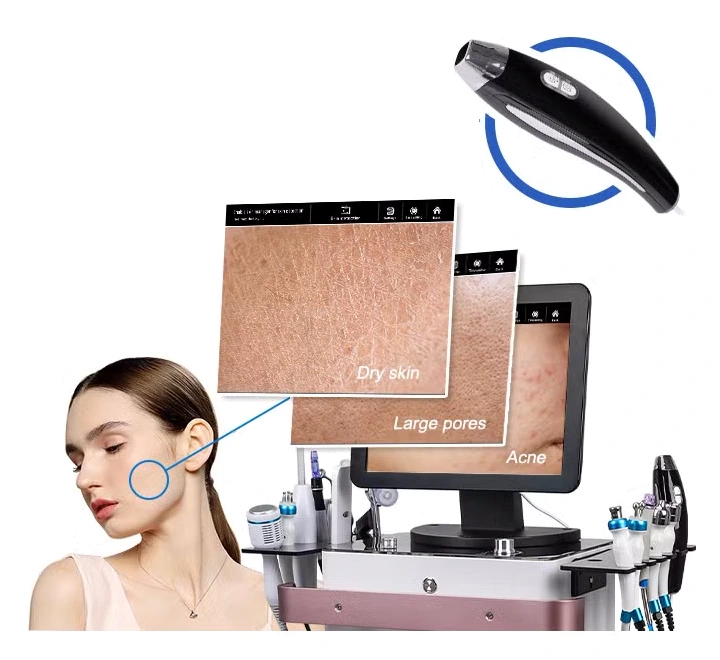 Hydrafacial 15+1 Profesyonel Cilt Bakım Cihazı – Saç ve Cilt Analiz Kameralı - Görsel 2